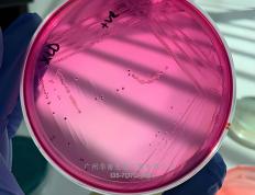 丹(dān)麦ssi中国官网中文(wén)版